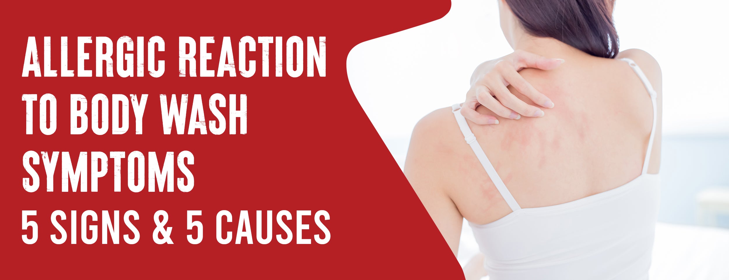 Body Wash Allergic Reaction Symptoms: Signs & Causes