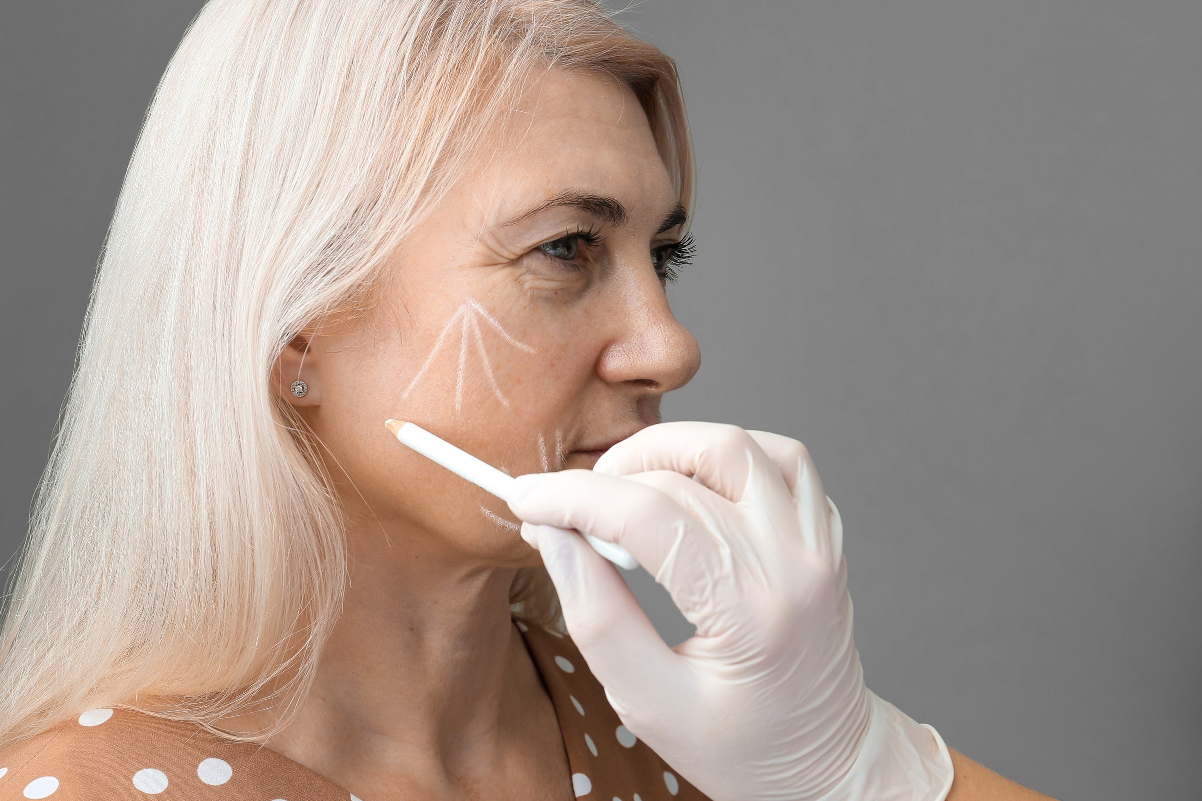 8 Benefits [and 8 Risks] of Botox