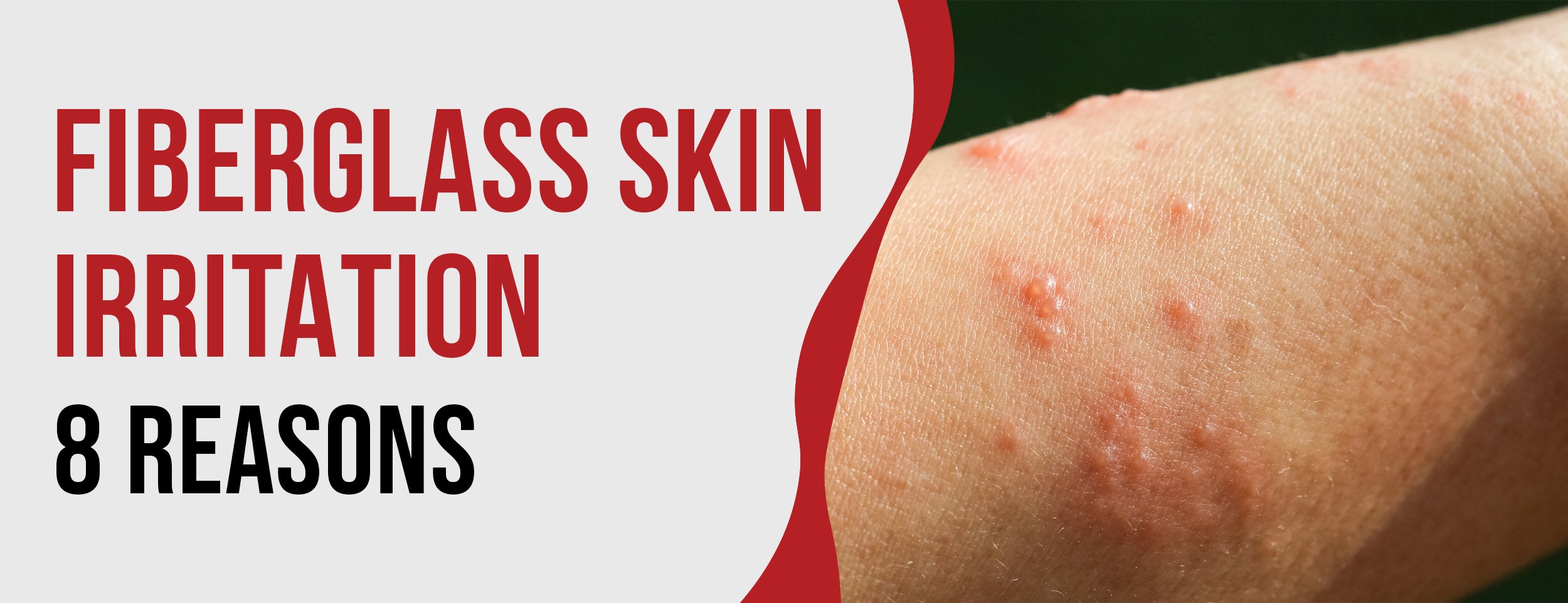 Irritation of the skin caused by fiberglass