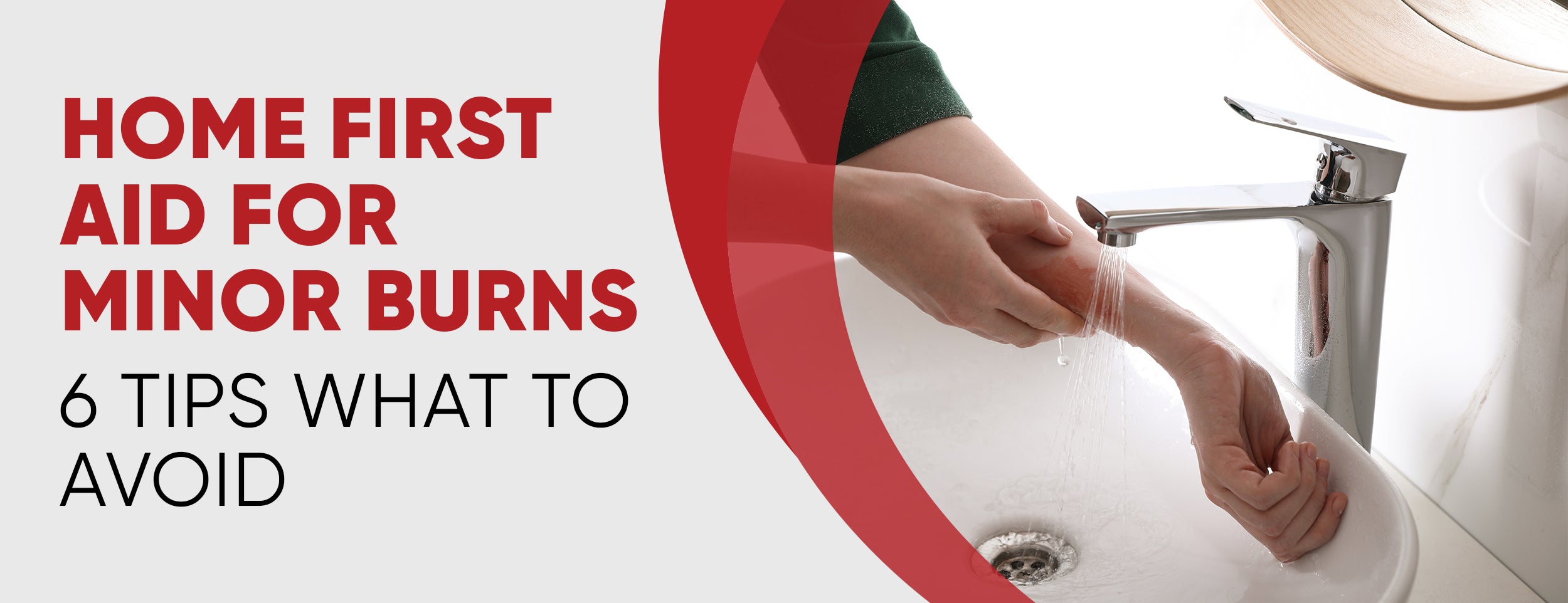 6 Essential Tips for Home First Aid for Minor Burns