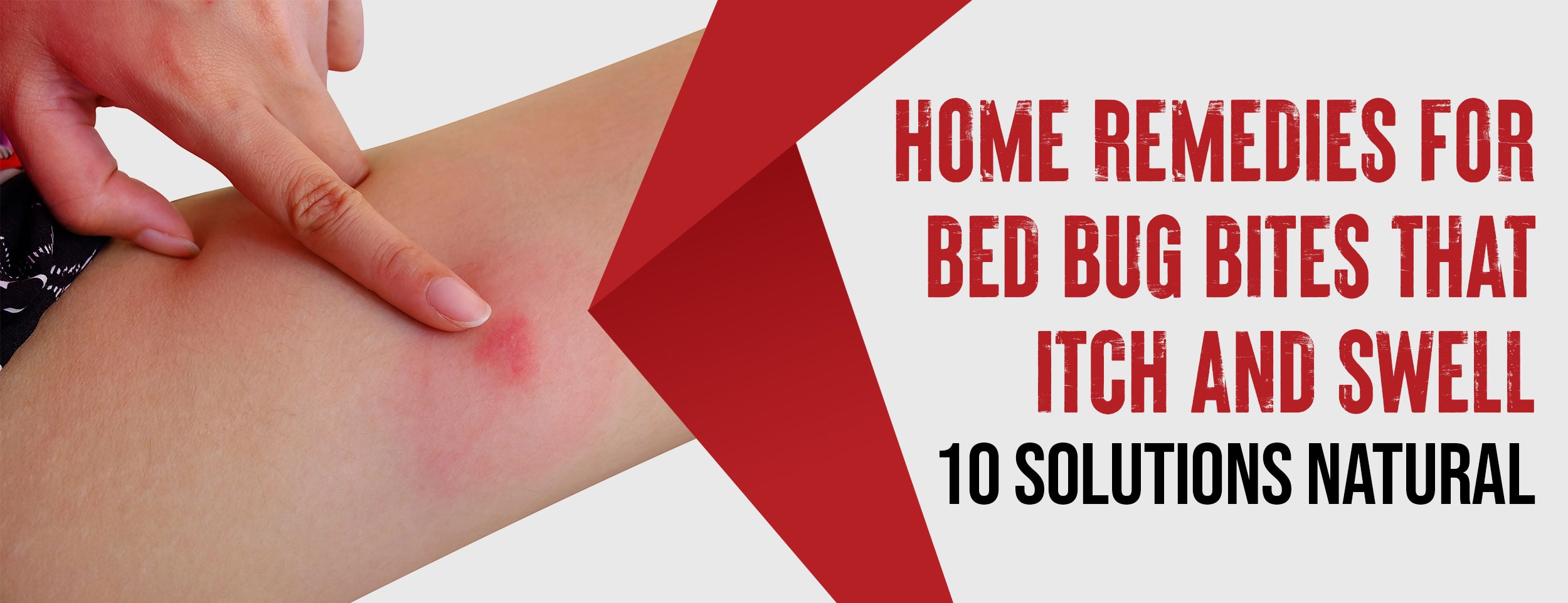 10 Natural Solutions for Itching Bed Bug Bites 6 Benefits