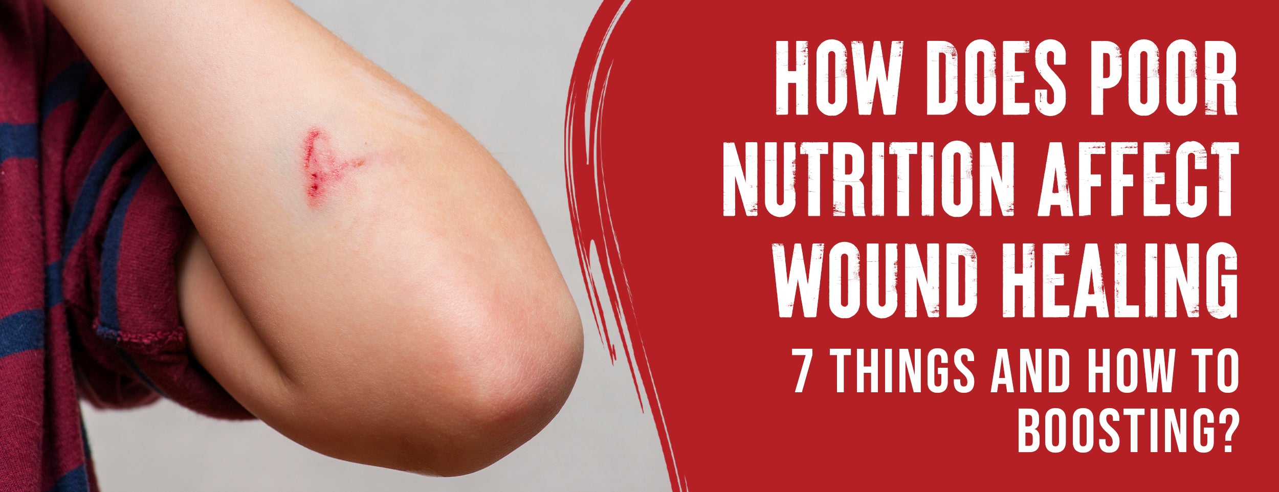 7 Processes of Wound Healing [Nutrition Recommendations]