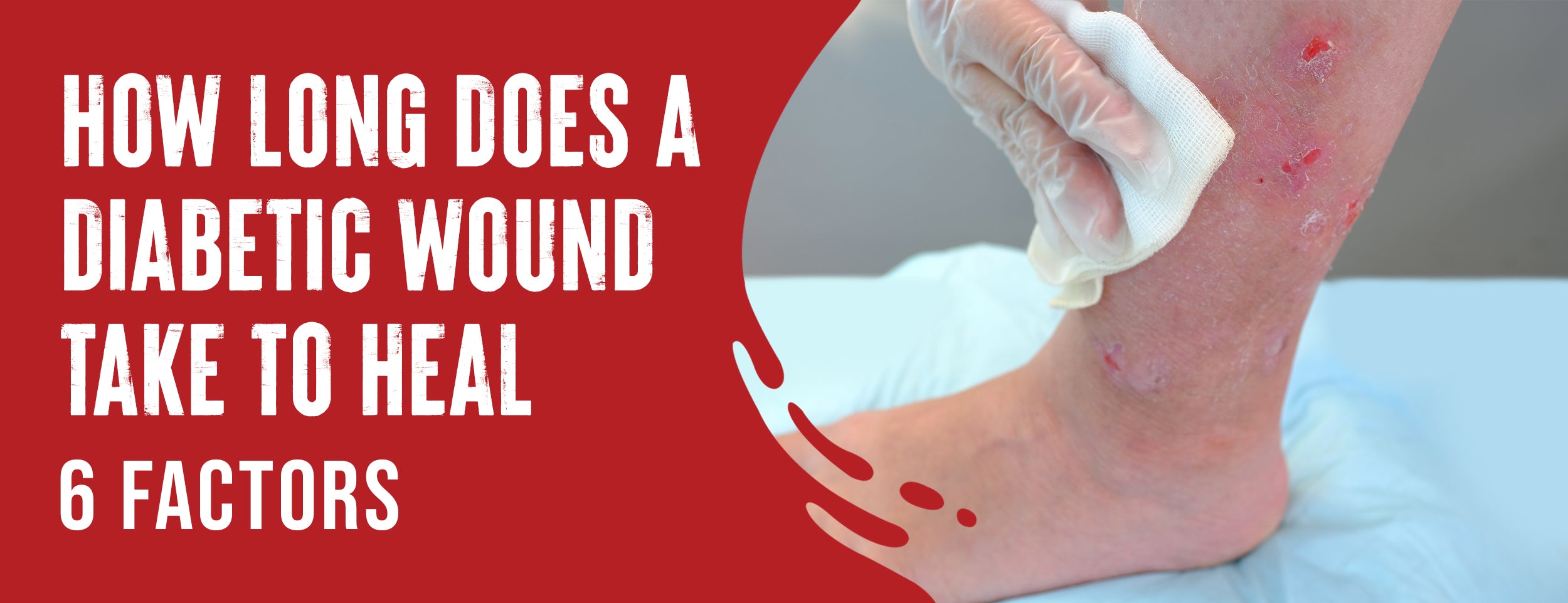 It is important to know how long it takes for a diabetic wound to heal