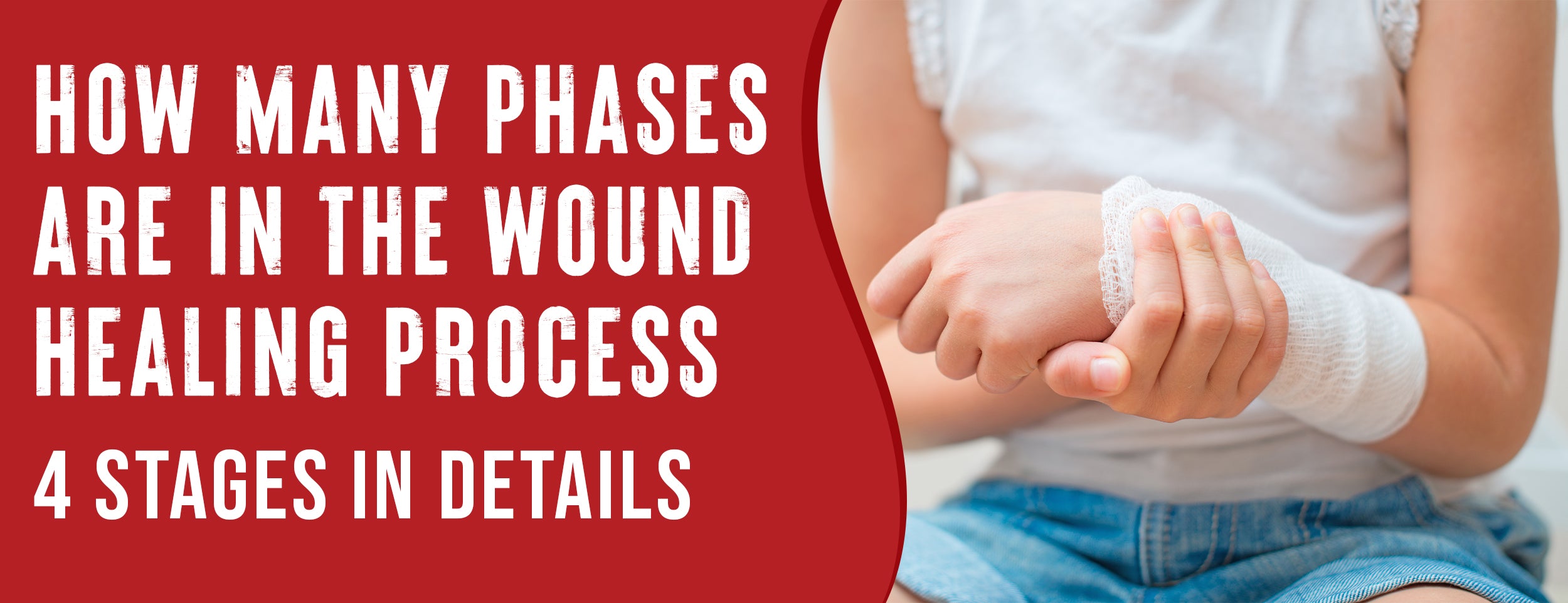 The wound healing process has four phases: