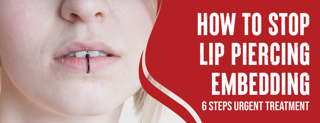 The Immediate Steps & Preventive Measures to Stop Lip Piercing Embedding