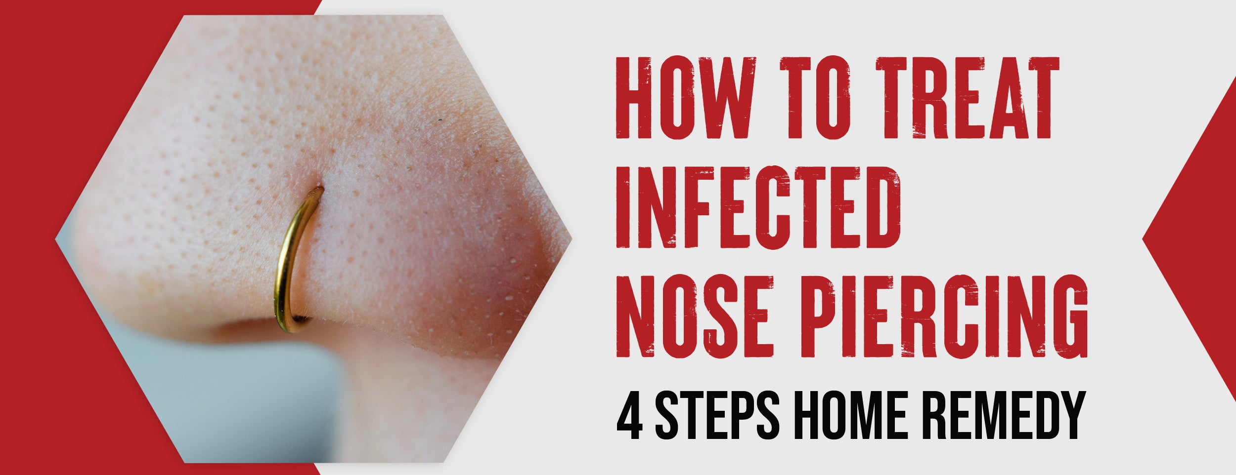 Home Remedies & Prevention Tips for Infected Nose Piercing