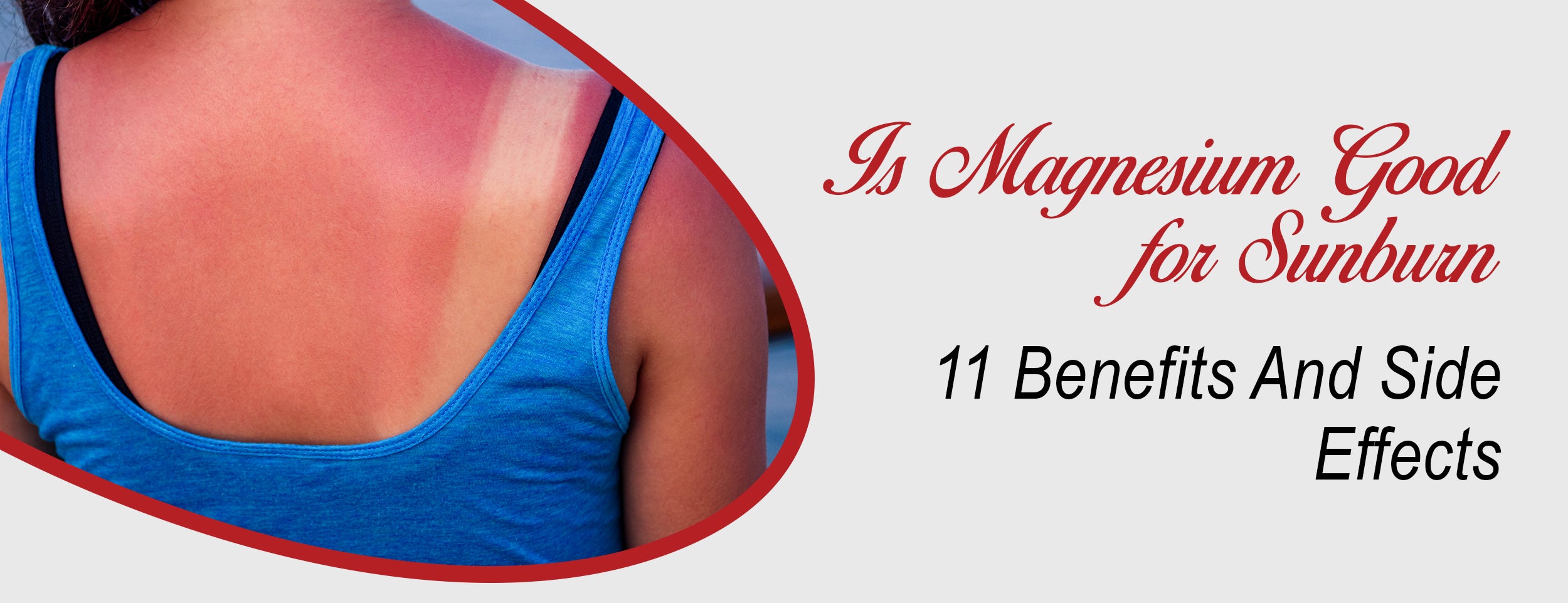 The Benefits & Side Effects of Magnesium for Sunburn