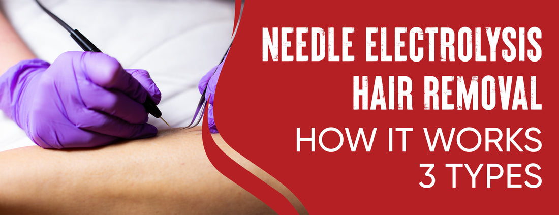  Laser Hair Removal Using Needle Electrolysis