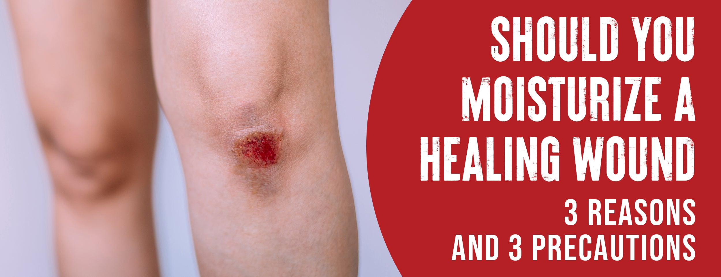 Moisturizing A Healing Wound: Science & 3 Common Methods [with Precautions]