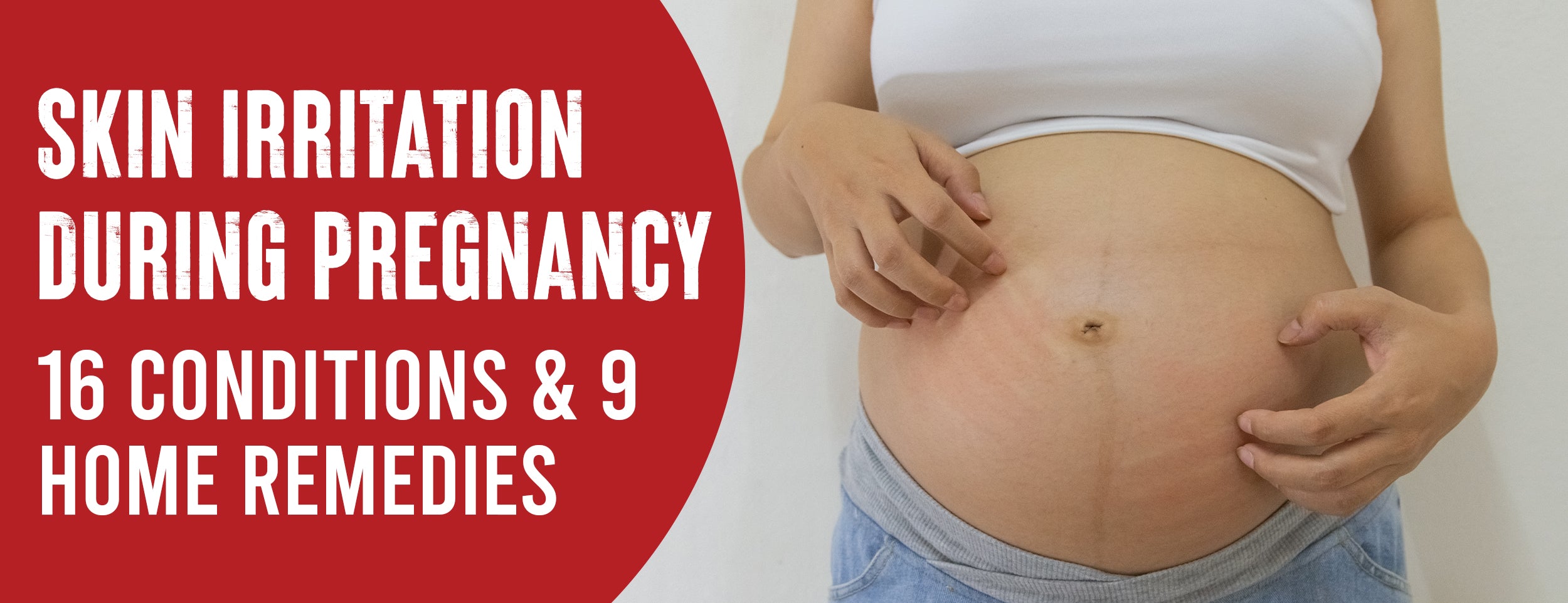 16 Common Conditions that Cause Skin Irritation During Pregnancy [Treatment Tips]