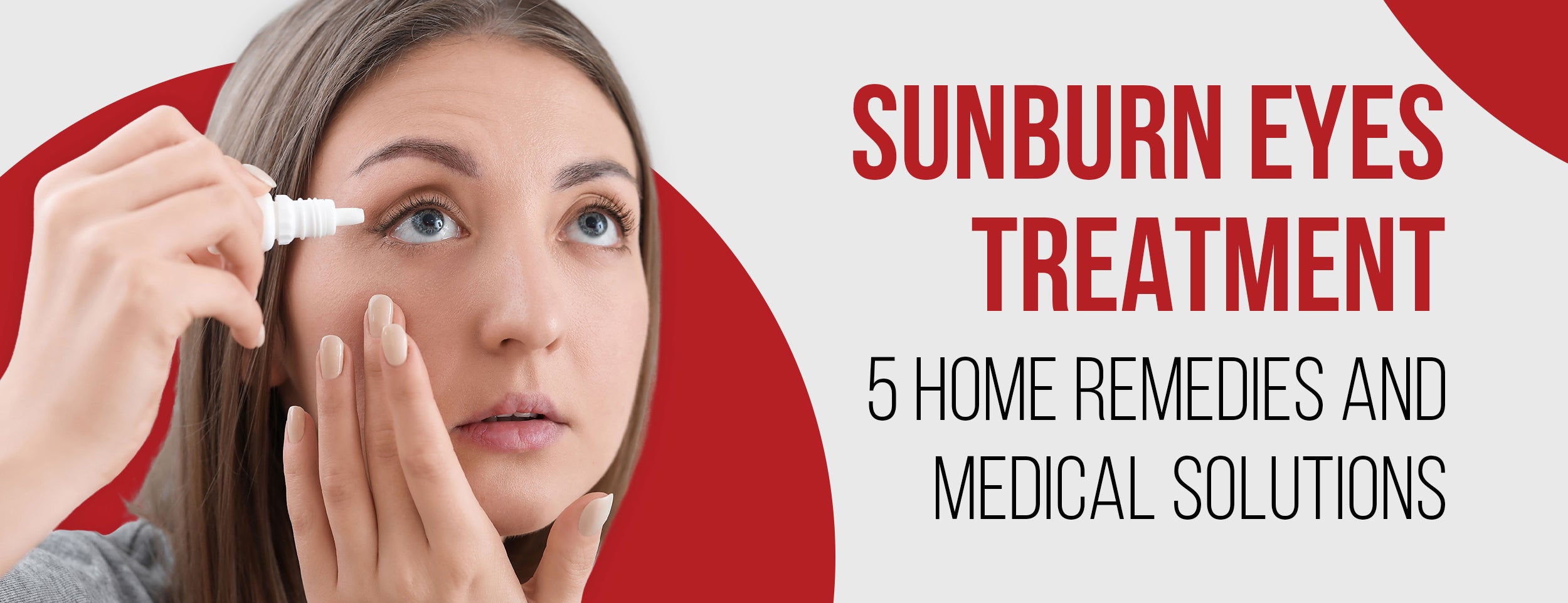 Home Remedies & Medical Solutions for Sunburned Eyes