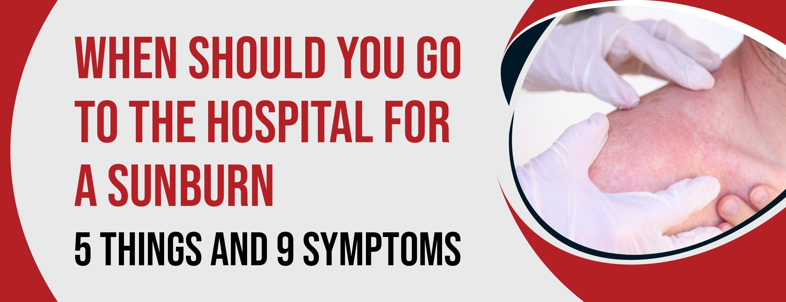 9 Sunburn Symptoms [5 Factors] When To Go To The Hospital
