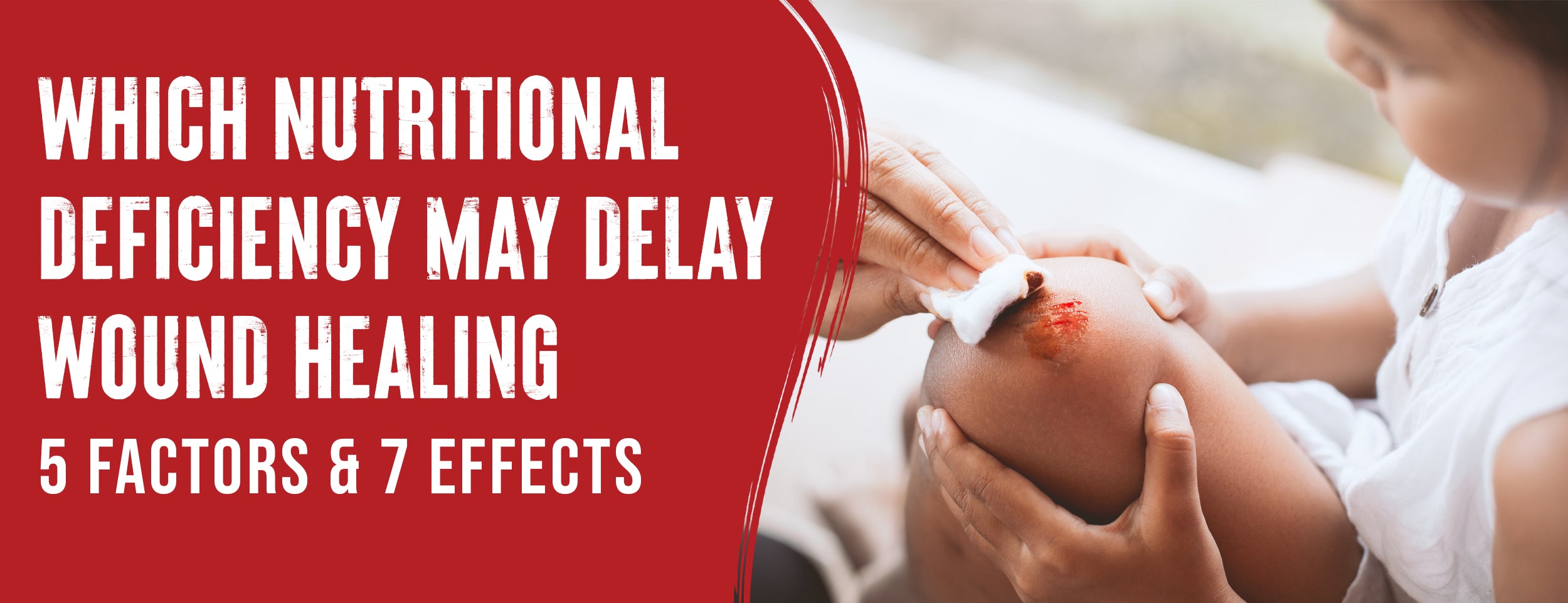 The 5 factors and 7 effects of nutritional deficiencies that delay wound healing