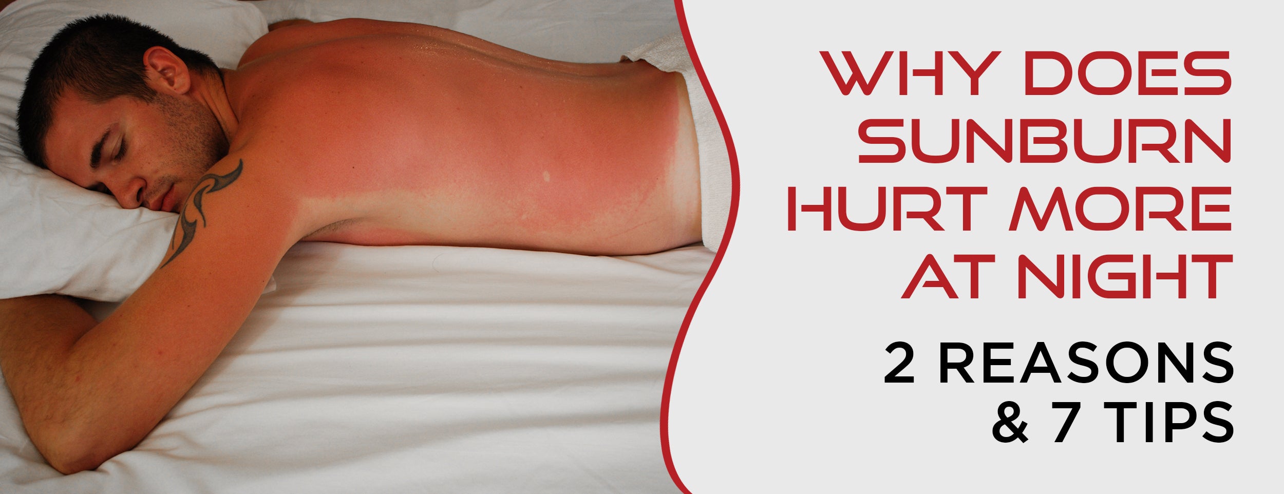 How To Sleep With Sunburn: Soothing Nighttime Tips