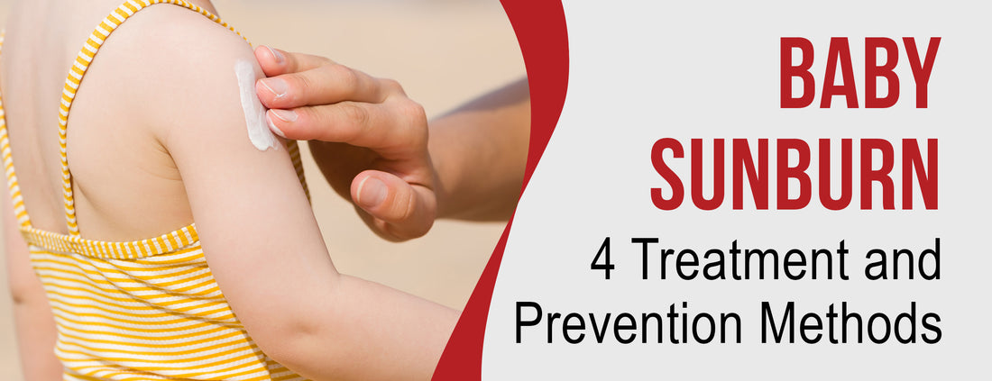 Four Treatment & Prevention Methods for Baby Sunburn