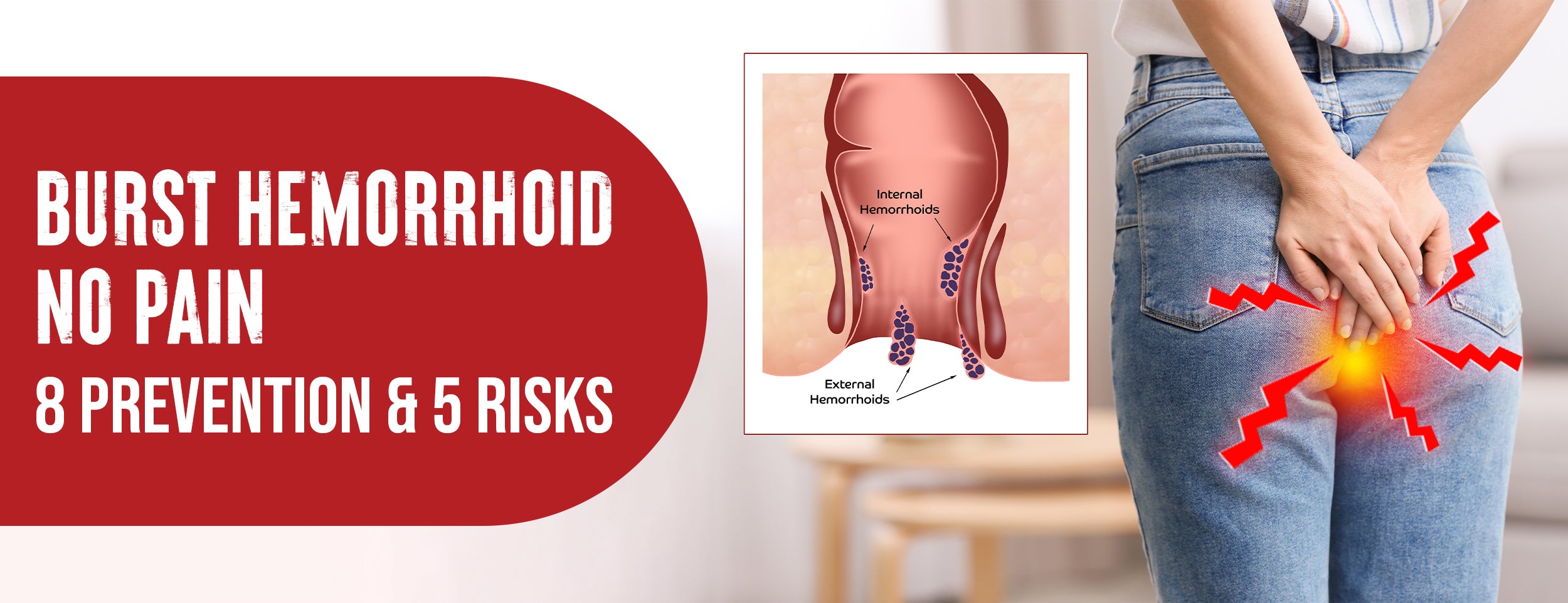 Burst Hemorrhoid No Pain: 5 Causes, 4 Symptoms & 4 Prevention