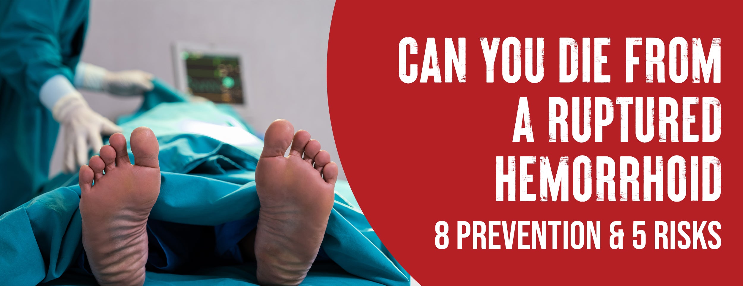 8 Preventative Measures & 5 Risks of Ruptured Hemorrhoids