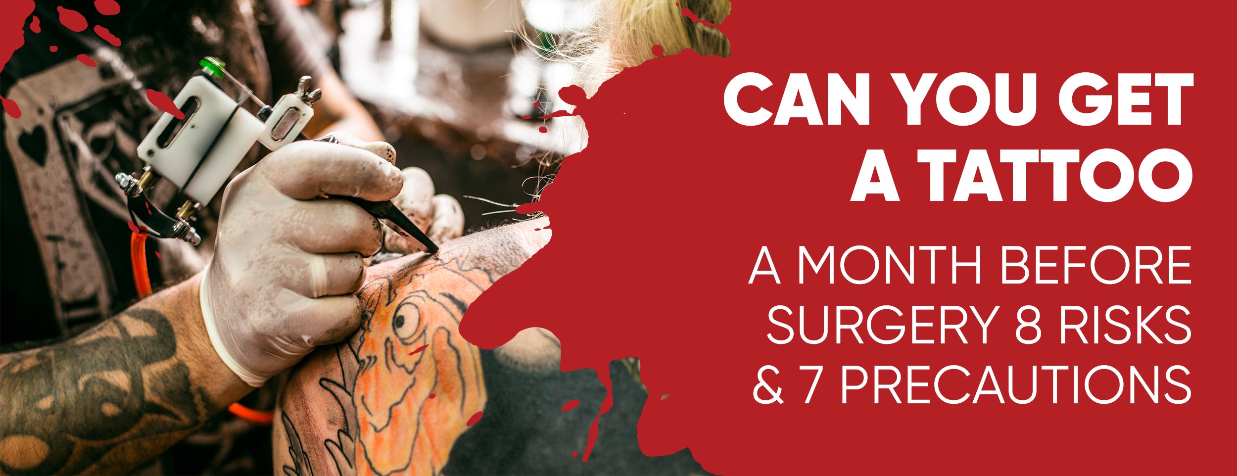 Can You Get a Tattoo a Month Before Surgery: 8 Risks – Dr. Numb®
