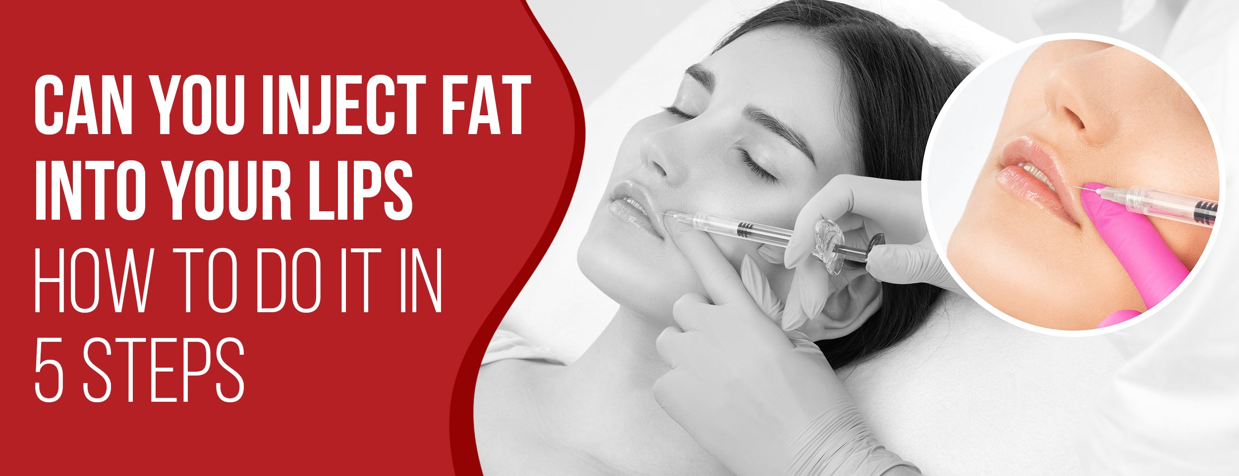 5 Steps & Factors [with Benefits] for Injecting Fat in Your Lips