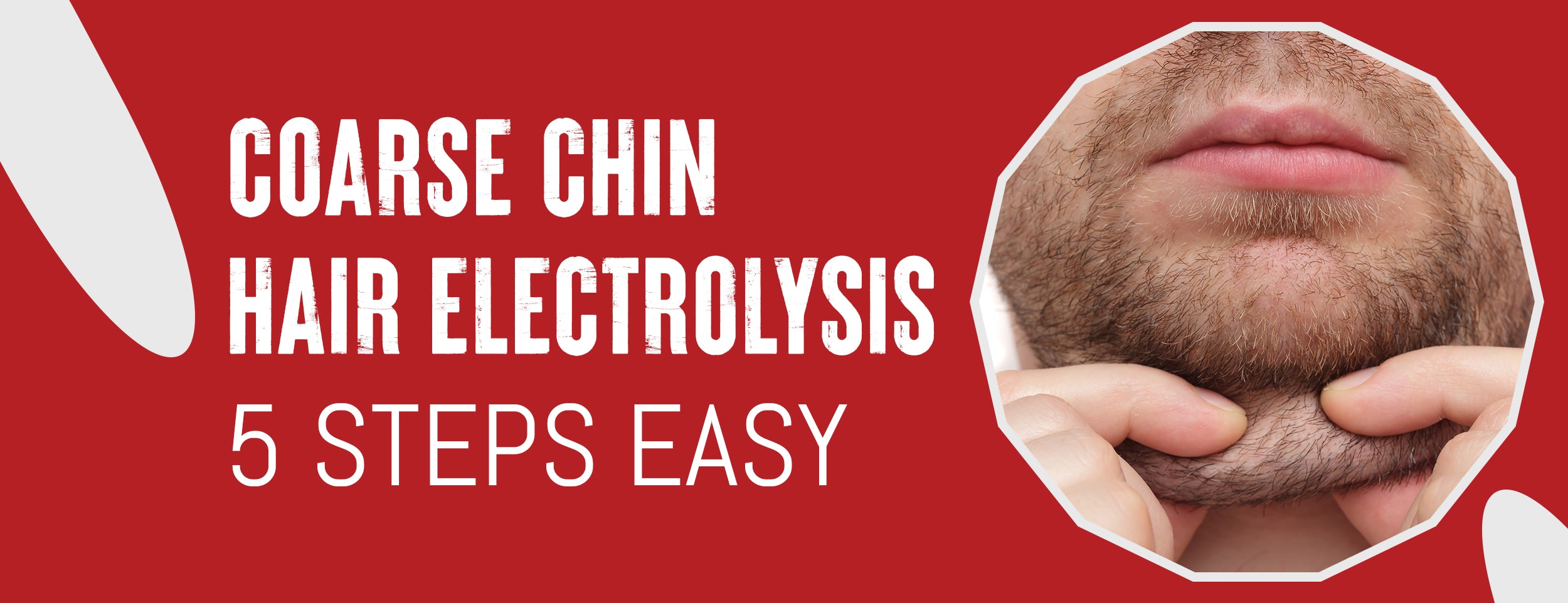 An electrolysis treatment for coarse chin hairs