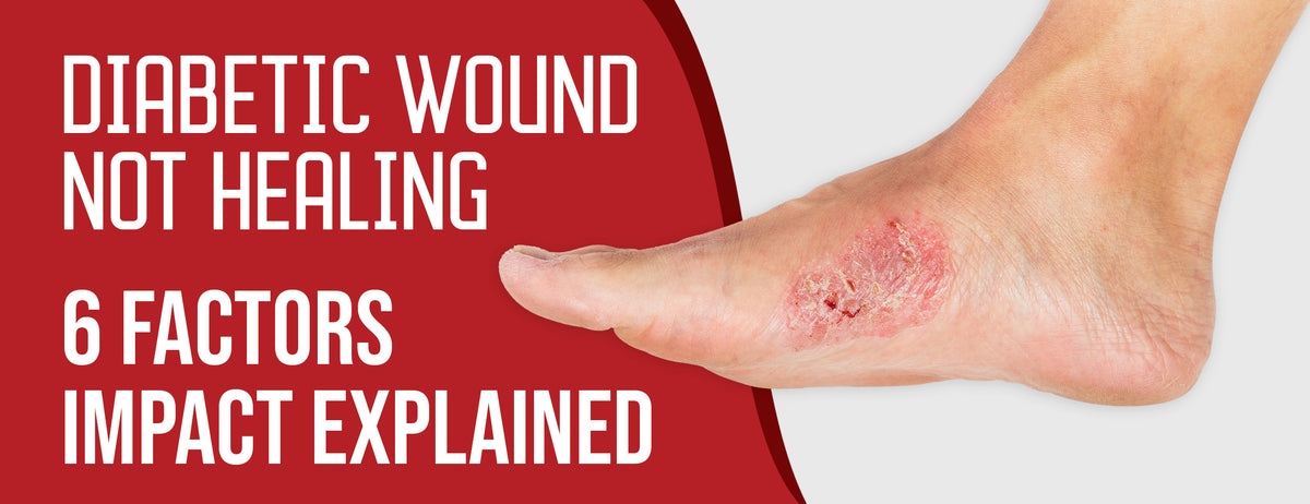 Diabetic Wound not Healing: 6 Factors [Impact Explained] – Dr. Numb®