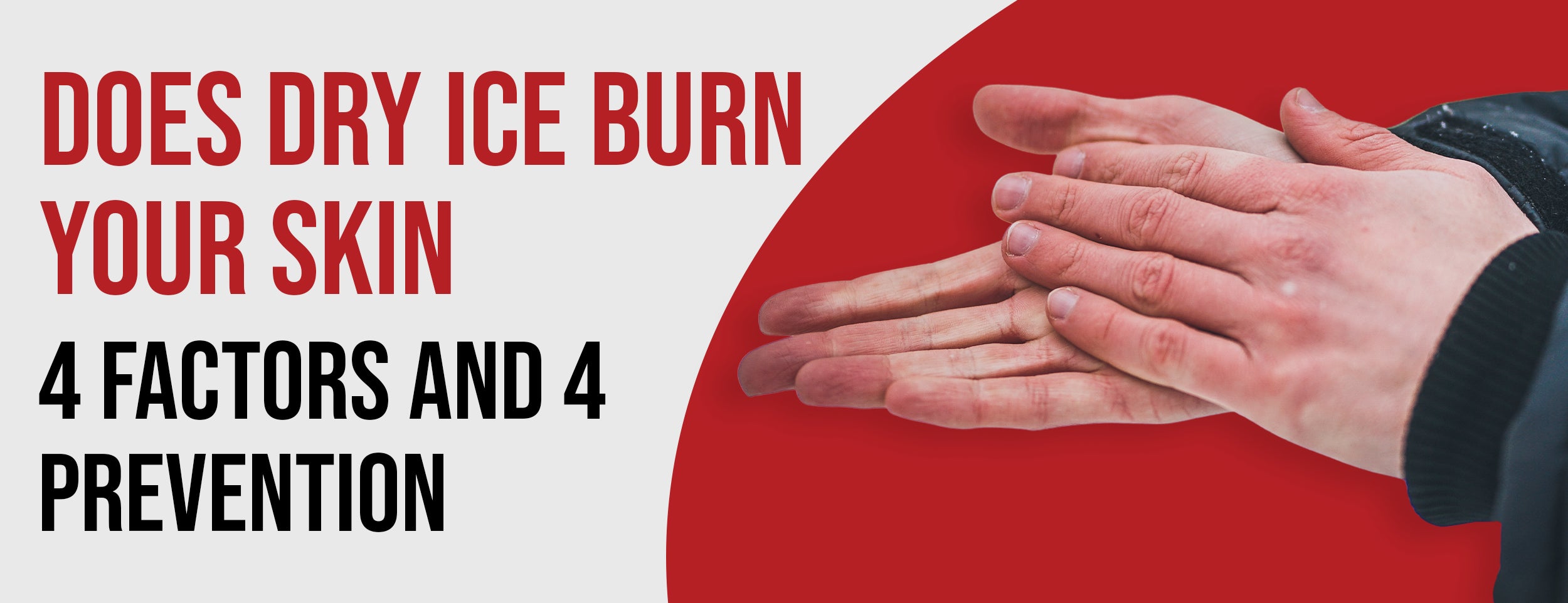 The 4 factors and 4 preventions of dry ice burn