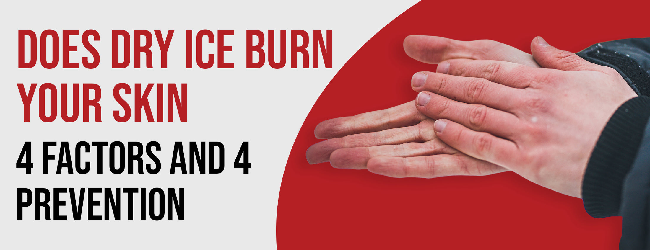 Does Dry Ice Burn Your Skin 4 Factors & 4 Prevention Dr. Numb®