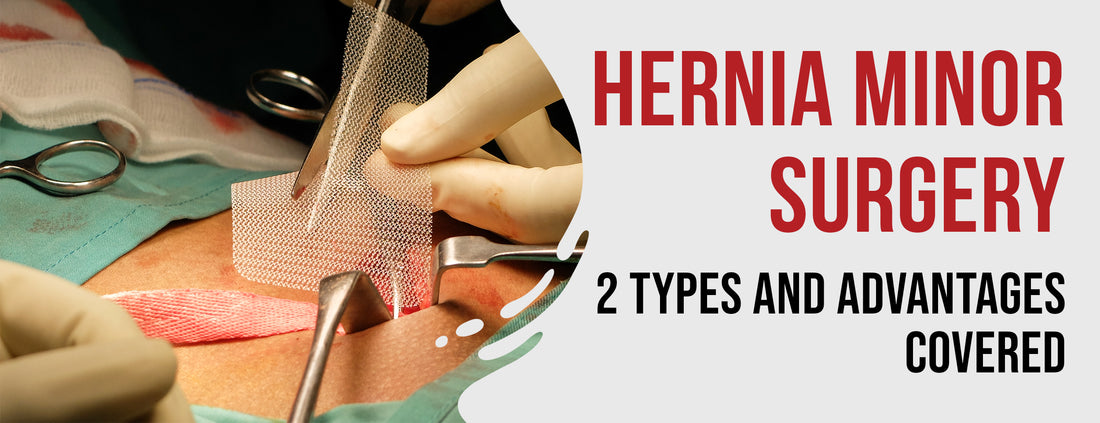 The two types of hernia surgery and their advantages [coverage]