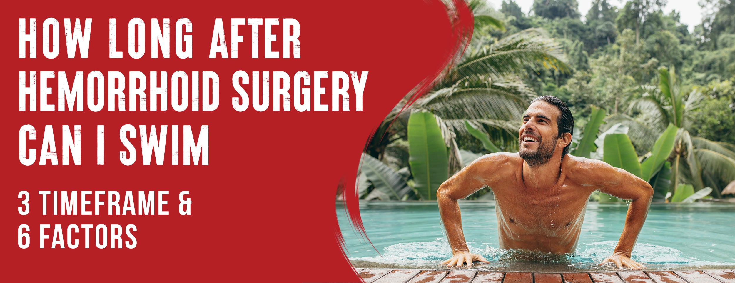 How Long After Hemorrhoid Surgery Can I Swim 3 Timeframe Dr. Numb®