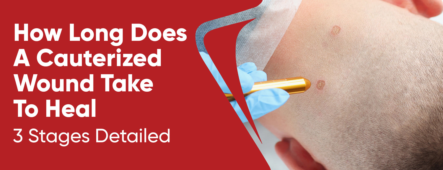 How Long Does A Cauterized Wound Take To Heal 3 Stages Dr. Numb®