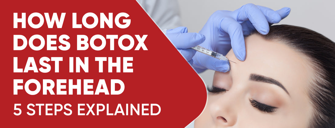 Botox lasts for a long time in the forehead when it is used properly