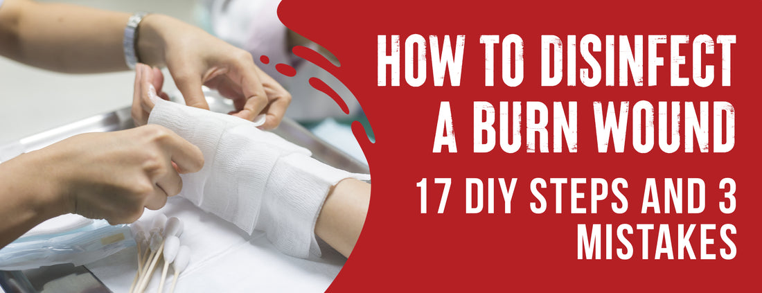 A Step-by-Step Guide To Disinfecting Burn Wounds