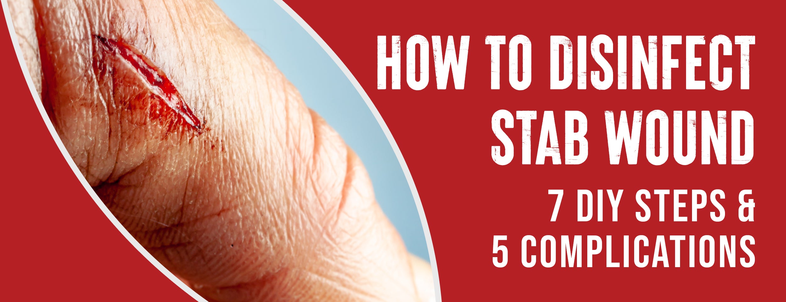 7 Tips To Disinfect Stab Wounds [5 Complications]