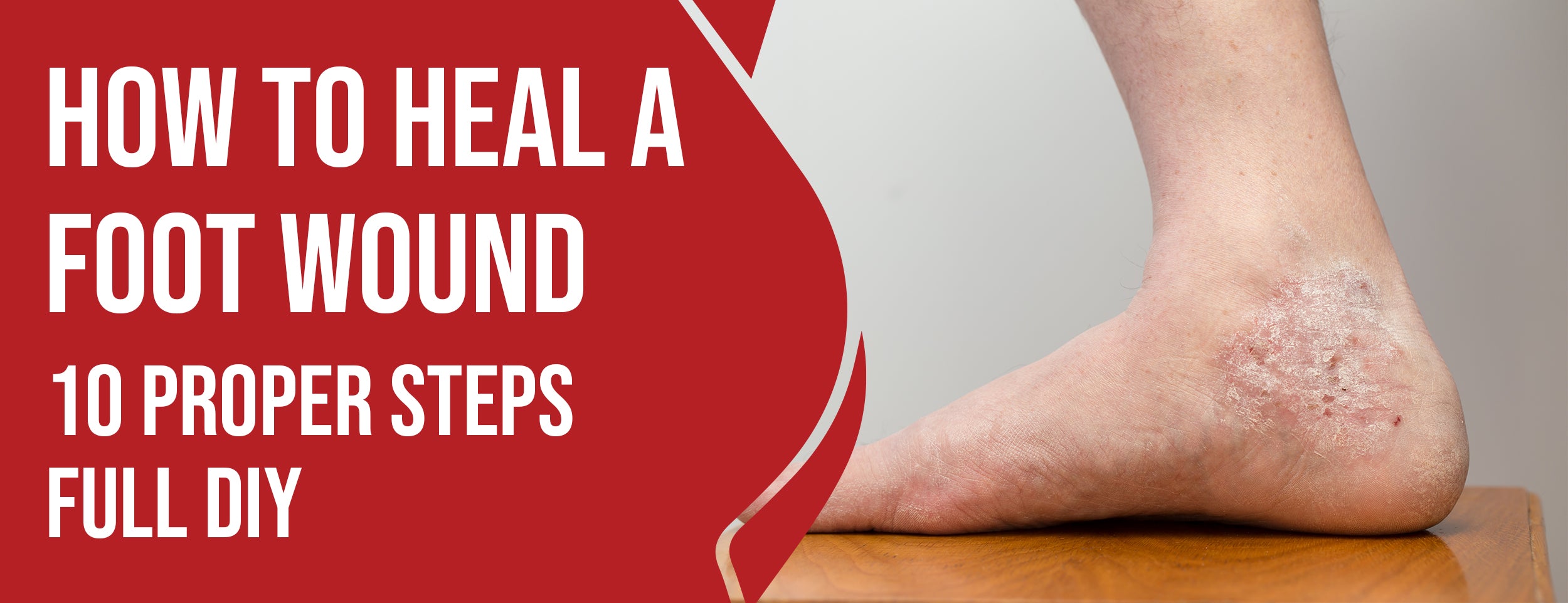 10 Steps To Heal A Foot Wound