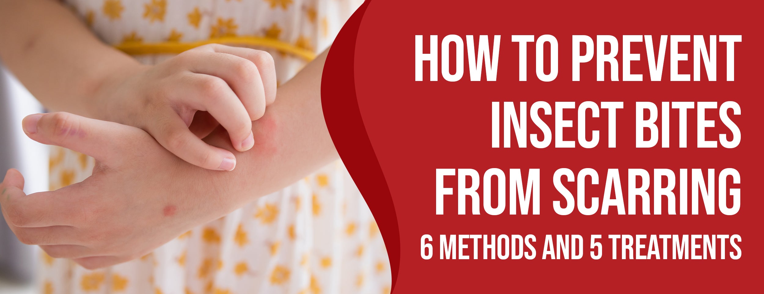 Insect Bites – Dr. Numb®