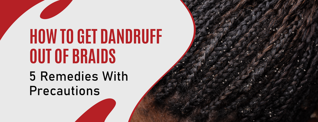 5 Best Tips and 3 Precautions for Removing Dandruff From Braids