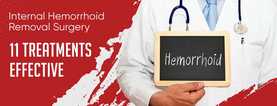 Removing internal hemorrhoids through surgery