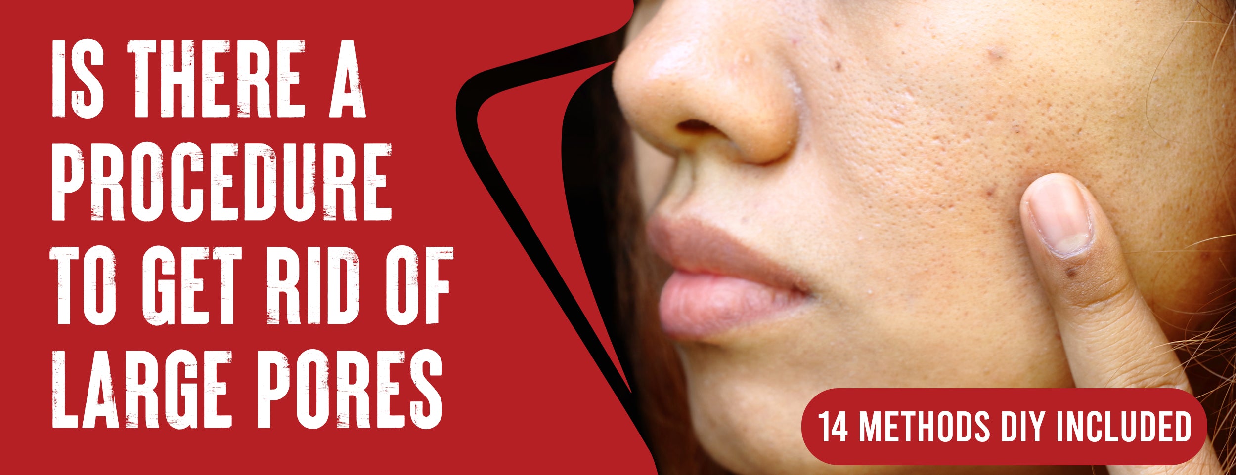 Explanation of the Most Effective 12 tips for Treating Large Pores