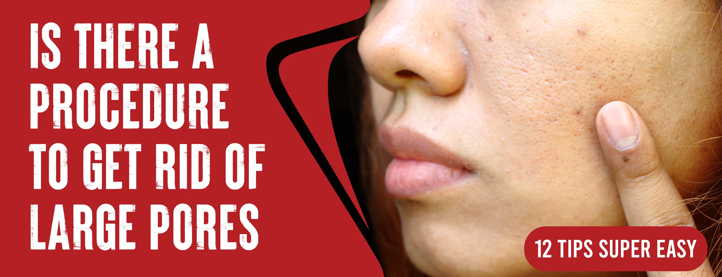Explanation of the Most Effective 12 tips for Treating Large Pores