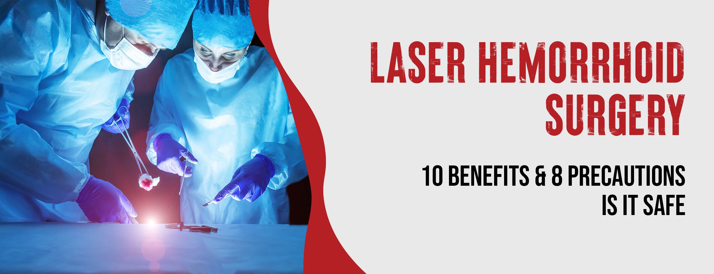 The 10 Benefits and 8 Precautions of Laser Hemorrhoids Surgery