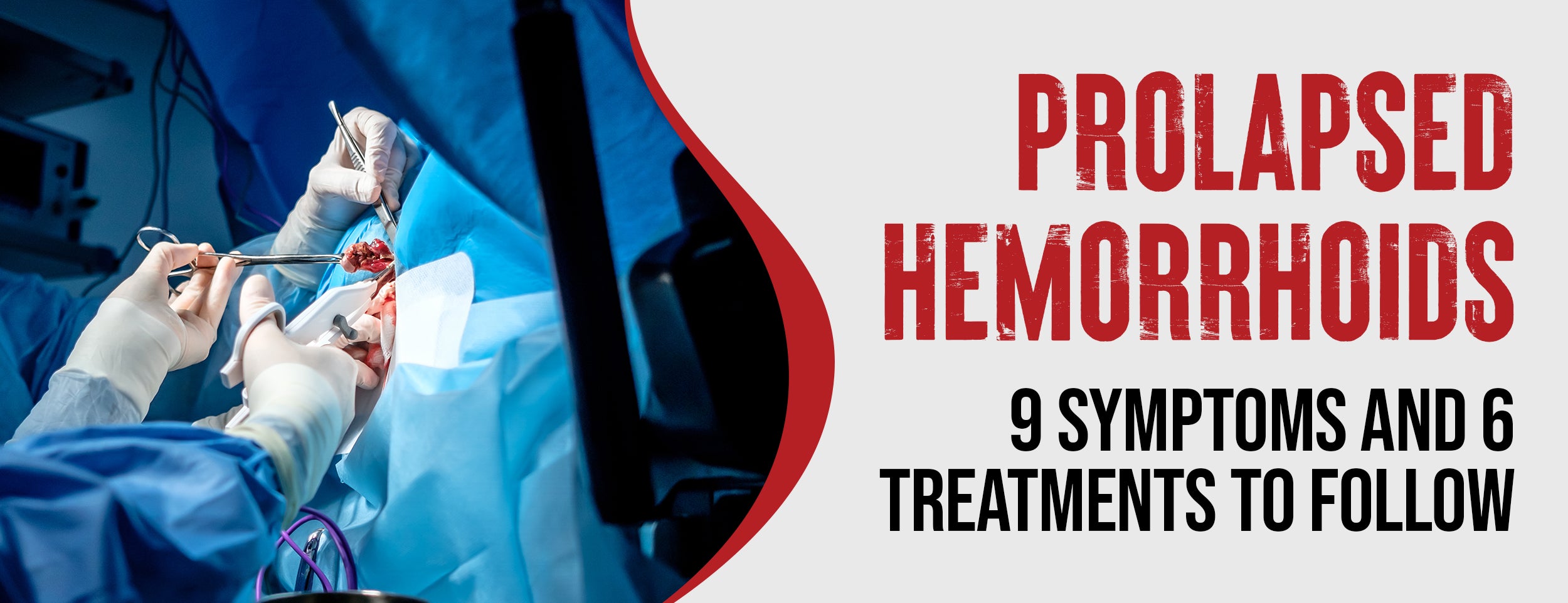 Here are 9 symptoms of prolapsed hemorrhoids, 6 treatments, and how to recover