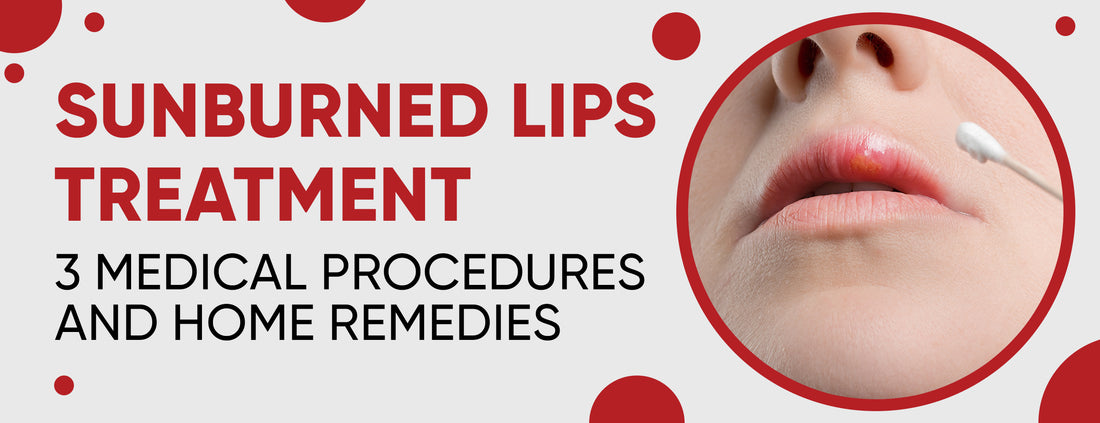 7 Natural Treatments For Sunburned Lips & Prevention Tips
