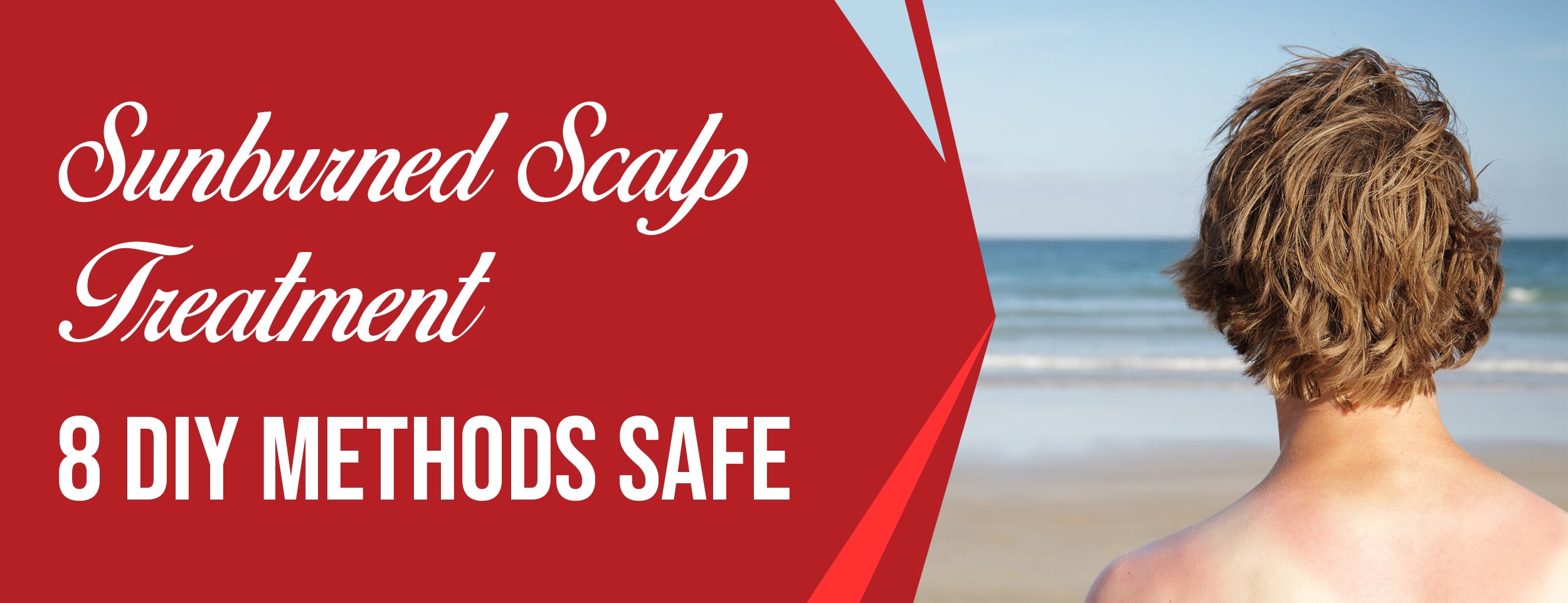 Sunburned Scalp Treatment 8 Diy Methods Safe Dr Numb®