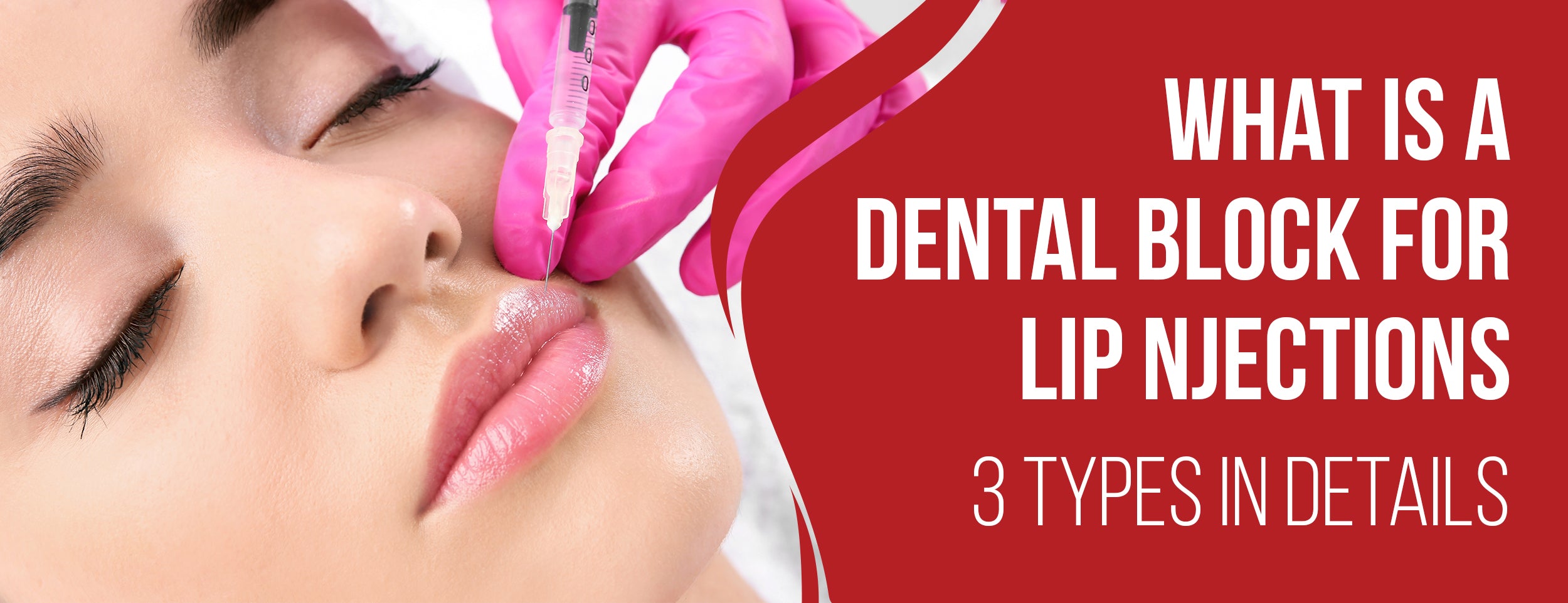 A Dental Block for Lip Injections: 3 Types & Effects
